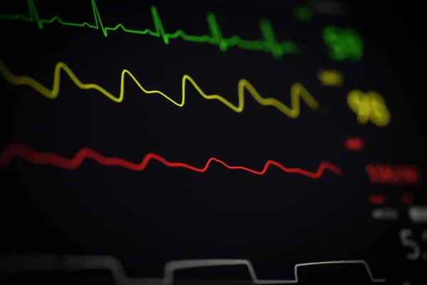 Ein Foto von einem weiteren EKG